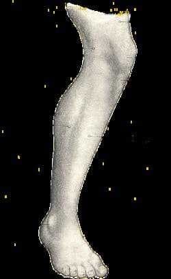 Sample of Leg