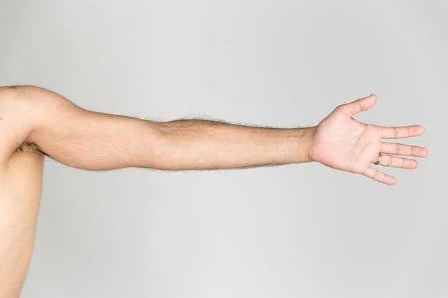 Sample of Arm