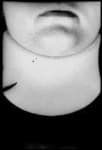 Sample 2 – Neck brace