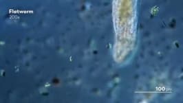 Sample of Parasitic flatworms