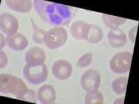 Sample of Neutrophil