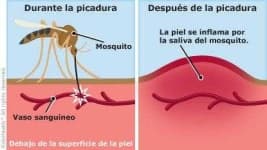 Sample 2 – Mosquito