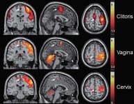 Sample 6 – Brain