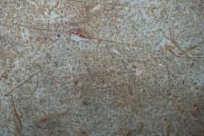 Sample 2 – Pitted
