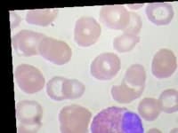 Sample 4 – Eosinophil