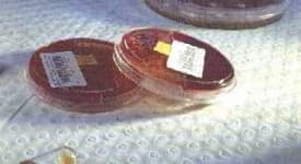 Sample 6 – Petri dish