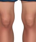 Sample 4 – Knee