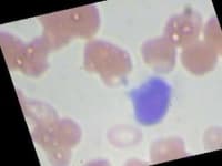 Sample 6 – Lymphocyte
