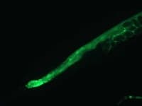 Sample of Nematode