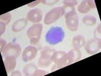 Sample 1 – Lymphocyte