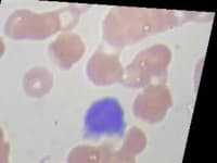 Sample 5 – Lymphocyte