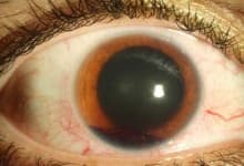 Sample 6 – Eye