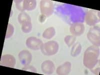 Sample 2 – Monocyte