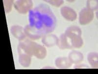 Sample 4 – Neutrophil