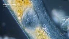 Sample 3 – Parasitic flatworms