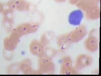Sample 2 – Lymphocyte