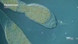 Sample 6 – Parasitic flatworms
