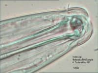 Sample 1 – Nematode