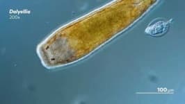 Sample 1 – Parasitic flatworms