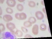 Sample 6 – Neutrophil