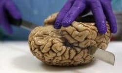 Sample 2 – Brain