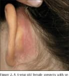 Sample 1 – Ear