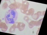 Sample 3 – Neutrophil