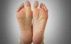 Sample 1 – Foot
