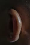 Sample 6 – Ear
