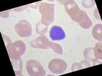 Sample 3 – Lymphocyte