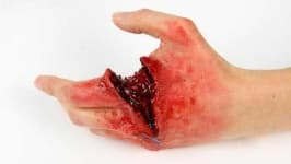 Sample 4 – Hand