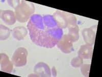 Sample 2 – Eosinophil