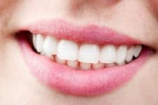 Sample 4 – Mouth