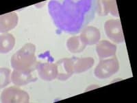Sample 5 – Monocyte