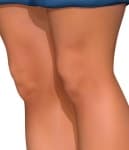 Sample 5 – Knee
