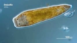 Sample 2 – Parasitic flatworms