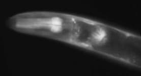 Sample 5 – Nematode