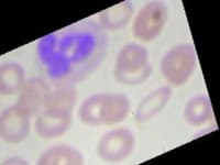 Sample 2 – Neutrophil
