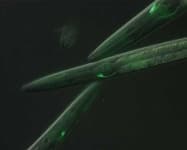Sample 6 – Nematode