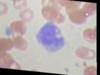 Sample 3 – Monocyte