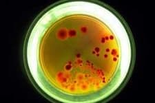 Sample 5 – Petri dish
