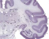 Sample 4 – Brain