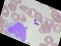 Sample of Monocyte