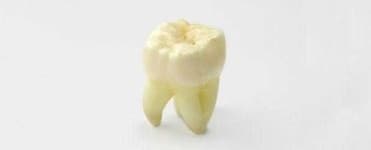 Sample 2 – Tooth