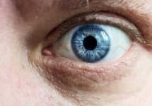 Sample 3 – Eye
