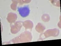 Sample 4 – Lymphocyte