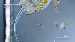 Sample 4 – Parasitic flatworms