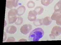 Sample of Eosinophil