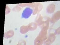 Sample of Lymphocyte