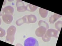 Sample 1 – Monocyte